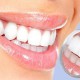 روکش های زیرکونیا dental4 80x80