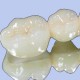دندان های خود را براق نگهدارید dental5 80x80