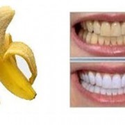 moz-180x180 moz-180x180 درباره سفیدی دندان با پوست موز چقدر اطلاعات دارید؟ moz 180x180