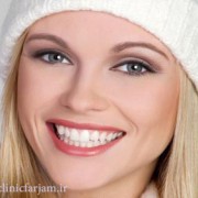 سفیدی و شفافیت دندانها  چند روش ساده برای سفیدی و شفافیت دندانها Best Smile 180x180