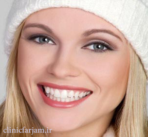 Best-Smile Best-Smile سفیدی و شفافیت دندانها چند روش ساده برای سفیدی و شفافیت دندانها Best Smile