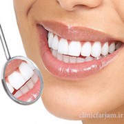 اهمیت دادن به سلامت دندان  به سلامت دندان هایتان بیشتر اهمیت دهید dandan2 180x180