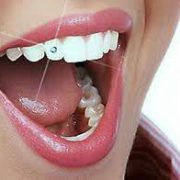 نگین های دندانی  آنچه در مورد چسباندن نگین بر روی دندان باید دانست. photo 2016 08 29 12 35 00 180x180