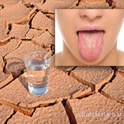 خشکی دهان و درمان آن  دلایل و درمان خشکی دهان khoshki dahan 180x180