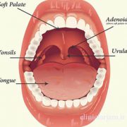 انواع قارچ در دهان  بررسی انواع قارچ در دهان gharch dahan 180x180
