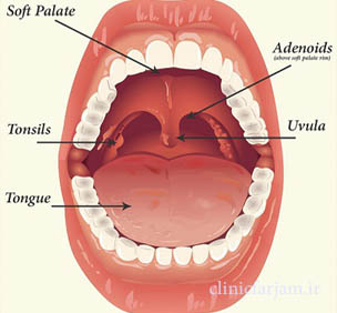 gharch-dahan gharch-dahan انواع قارچ در دهان بررسی انواع قارچ در دهان gharch dahan