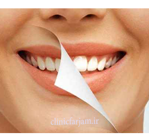 jermgiri jermgiri نکاتی در مورد جرمگیری نکاتی درمورد جرمگیری jermgiri