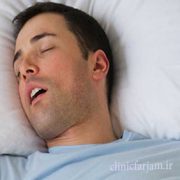 خوابیدن با دهان باز  خوابیدن با دهان باز و افزایش پوسیدگی دندان khab posidgi 180x180