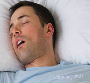 khab-posidgi khab-posidgi خوابیدن با دهان باز خوابیدن با دهان باز و افزایش پوسیدگی دندان khab posidgi