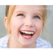 زود افتادن دندان شیری  آیا در همه موارد زود افتادن دندان شیری باید فضا نگهدار استفاده شود؟ fazanghdar 180x180